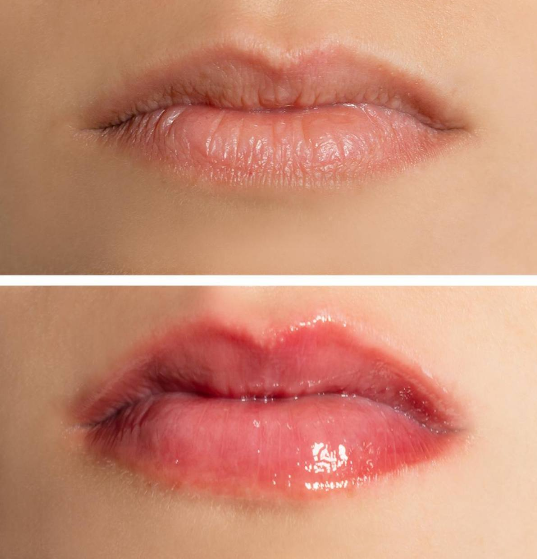 Spicy Gloss – Extra Volumen 7 ml